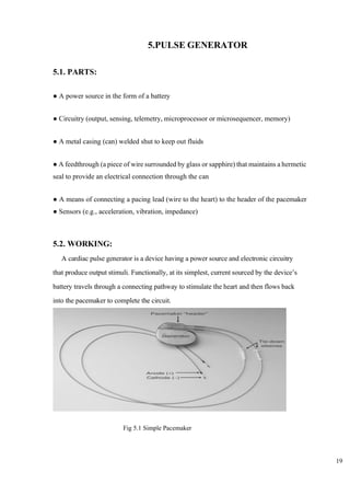 19
5.PULSE GENERATOR
5.1. PARTS:
● A power source in the form of a battery
● Circuitry (output, sensing, telemetry, microprocessor or microsequencer, memory)
● A metal casing (can) welded shut to keep out fluids
● A feedthrough (a piece of wire surrounded by glass or sapphire) that maintains a hermetic
seal to provide an electrical connection through the can
● A means of connecting a pacing lead (wire to the heart) to the header of the pacemaker
● Sensors (e.g., acceleration, vibration, impedance)
5.2. WORKING:
A cardiac pulse generator is a device having a power source and electronic circuitry
that produce output stimuli. Functionally, at its simplest, current sourced by the device’s
battery travels through a connecting pathway to stimulate the heart and then flows back
into the pacemaker to complete the circuit.
Fig 5.1 Simple Pacemaker
 