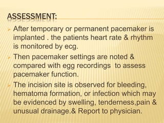 Pacemaker Reporting Pacemaker Implant | PPTX