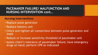 Decrease Sensitivity Pacemaker PACEMAKER PPT.pptx