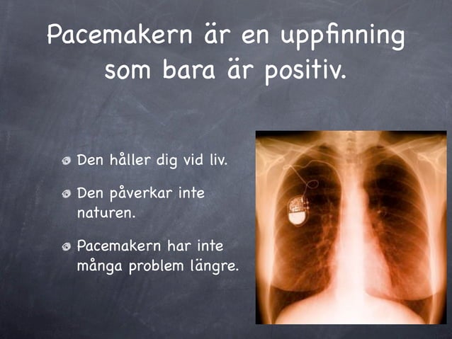 Pacemaker presentation | PPT