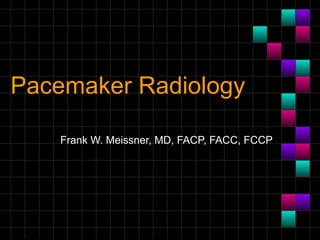 Pacemaker Radiology
Frank W. Meissner, MD, FACP, FACC, FCCP
 