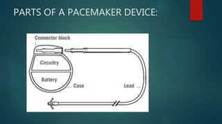 Pace makers | PPTX