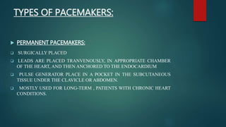 Pace makers | PPTX