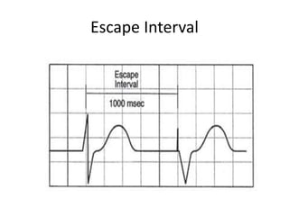 Escape Interval
 