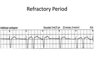 Refractory Period
 
