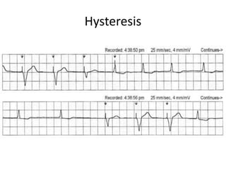 Hysteresis
 