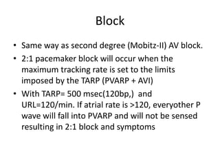 Block
• Same way as second degree (Mobitz-II) AV block.
• 2:1 pacemaker block will occur when the
maximum tracking rate is set to the limits
imposed by the TARP (PVARP + AVI)
• With TARP= 500 msec(120bp,) and
URL=120/min. If atrial rate is >120, everyother P
wave will fall into PVARP and will not be sensed
resulting in 2:1 block and symptoms
 