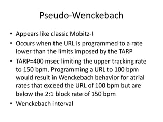 Pseudo-Wenckebach
• Appears like classic Mobitz-I
• Occurs when the URL is programmed to a rate
lower than the limits imposed by the TARP
• TARP=400 msec limiting the upper tracking rate
to 150 bpm. Programming a URL to 100 bpm
would result in Wenckebach behavior for atrial
rates that exceed the URL of 100 bpm but are
below the 2:1 block rate of 150 bpm
• Wenckebach interval
 