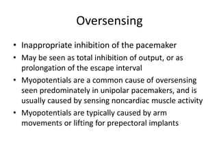 Oversensing
• Inappropriate inhibition of the pacemaker
• May be seen as total inhibition of output, or as
prolongation of the escape interval
• Myopotentials are a common cause of oversensing
seen predominately in unipolar pacemakers, and is
usually caused by sensing noncardiac muscle activity
• Myopotentials are typically caused by arm
movements or lifting for prepectoral implants
 