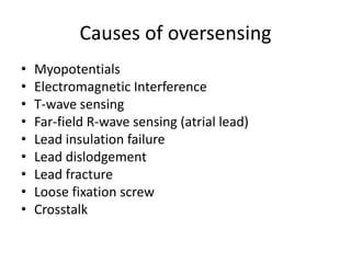 Causes of oversensing
• Myopotentials
• Electromagnetic Interference
• T-wave sensing
• Far-field R-wave sensing (atrial lead)
• Lead insulation failure
• Lead dislodgement
• Lead fracture
• Loose fixation screw
• Crosstalk
 