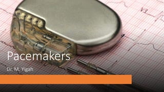 General Overview of Modern Cardiac Pacemakers | PPTX