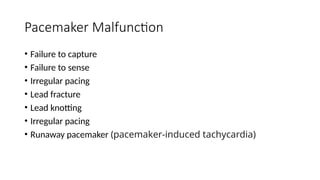 Runawau Pacemaker General Overview of Modern Cardiac Pacemakers | PPTX