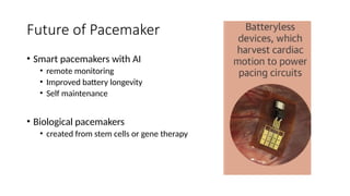Future Pacemaker Image General Overview of Modern Cardiac Pacemakers | PPTX