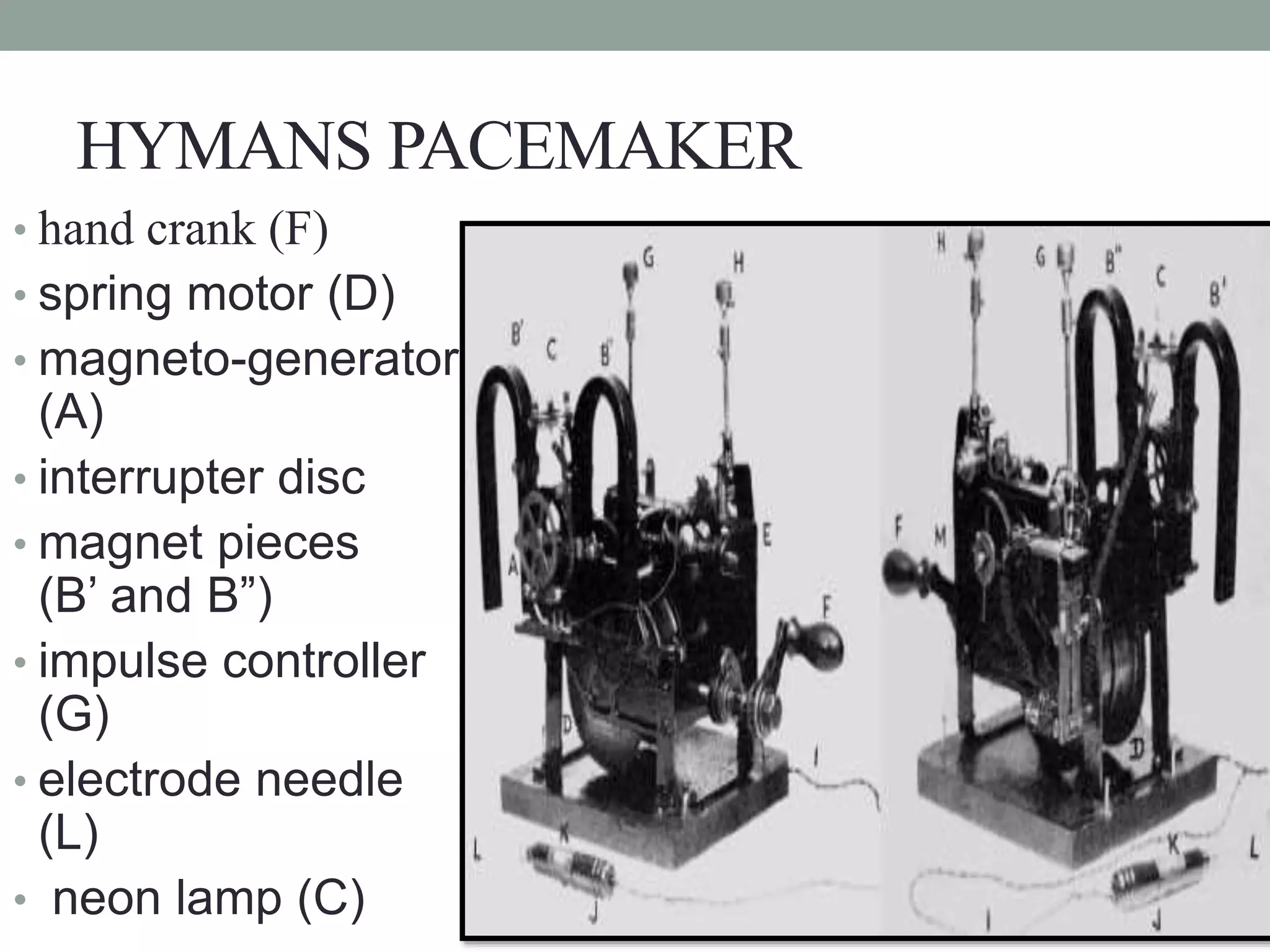 HYMANS PACEMAKER
• hand crank (F)
• spring motor (D)
• magneto-generator
(A)
• interrupter disc
• magnet pieces
(B’ and B”)
• impulse controller
(G)
• electrode needle
(L)
• neon lamp (C)