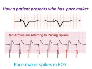 Pace maker professor md toufiqur rahman | PPS