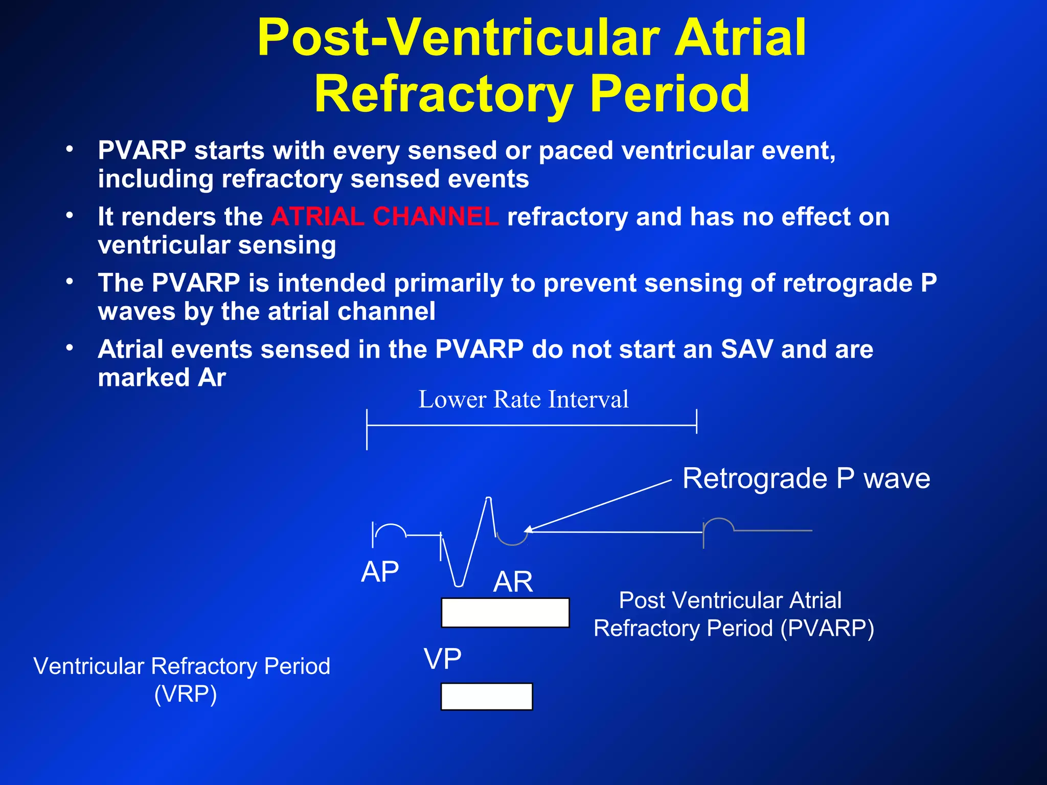 Post Ventricular Atrial
Refractory Period (PVARP)
Post-Ventricular Atrial
Refractory Period
• PVARP starts with every sensed or paced ventricular event,
including refractory sensed events
• It renders the ATRIAL CHANNEL refractory and has no effect on
ventricular sensing
• The PVARP is intended primarily to prevent sensing of retrograde P
waves by the atrial channel
• Atrial events sensed in the PVARP do not start an SAV and are
marked Ar
AP
VPVentricular Refractory Period
(VRP)
Retrograde P wave
Lower Rate Interval
AR
 