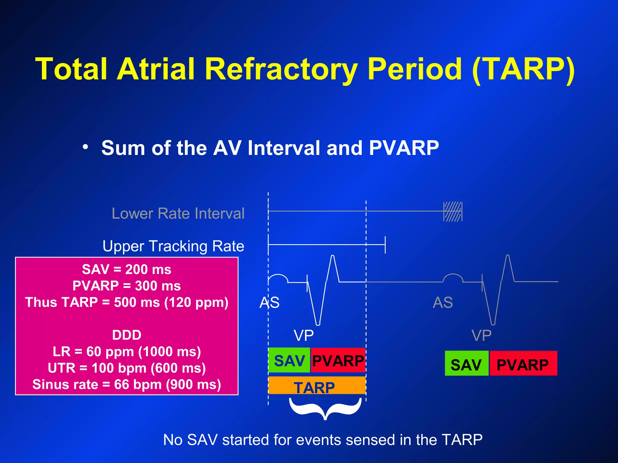 PVARP
Upper Tracking Rate
Lower Rate Interval
{
No SAV started for events sensed in the TARP
AS AS
VPVP
SAV = 200 ms
PVARP = 300 ms
Thus TARP = 500 ms (120 ppm)
DDD
LR = 60 ppm (1000 ms)
UTR = 100 bpm (600 ms)
Sinus rate = 66 bpm (900 ms)
SAV
TARP
PVARP
Total Atrial Refractory Period (TARP)
• Sum of the AV Interval and PVARP
SAV
 