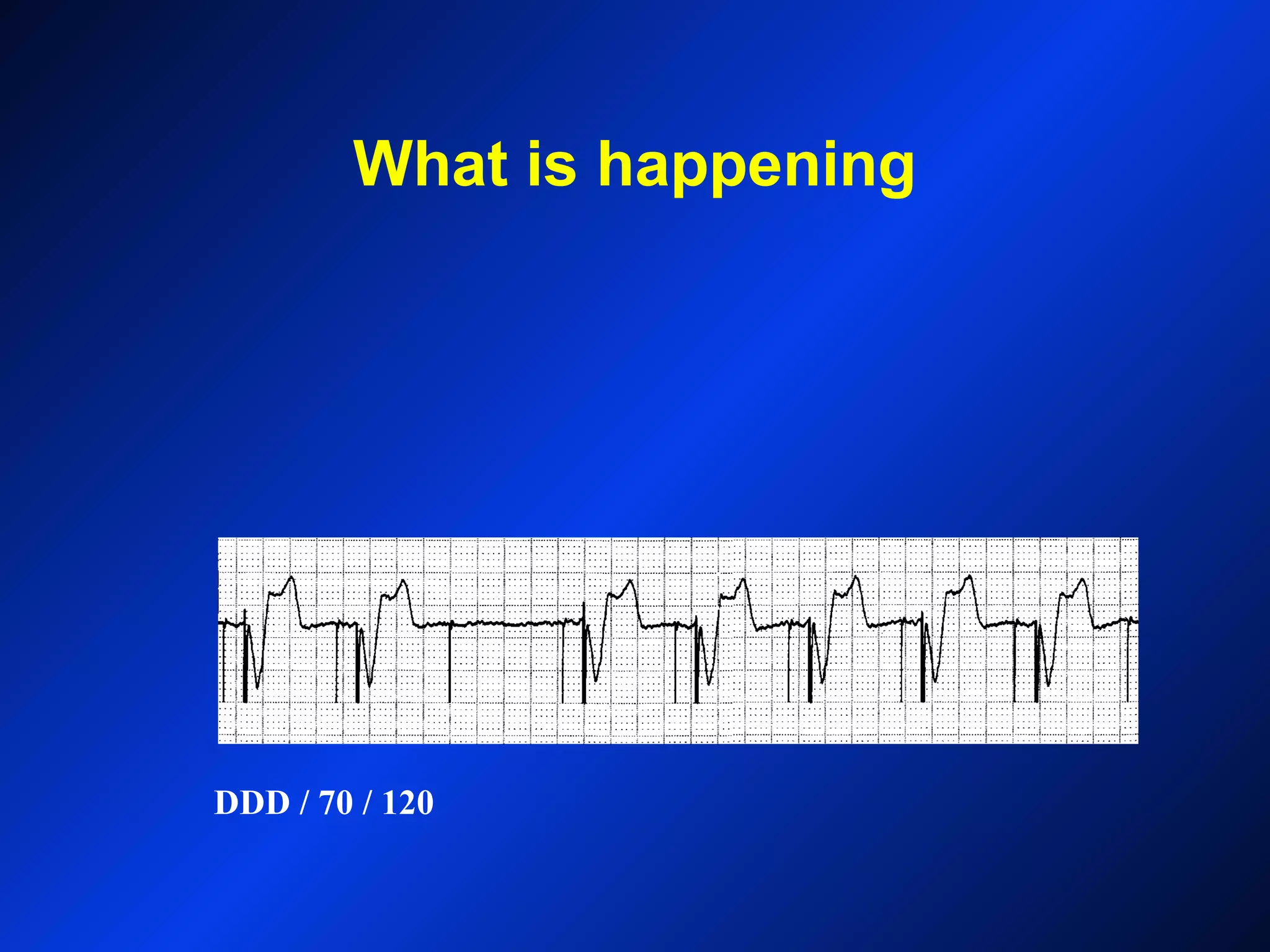 What is happening
DDD / 70 / 120
 