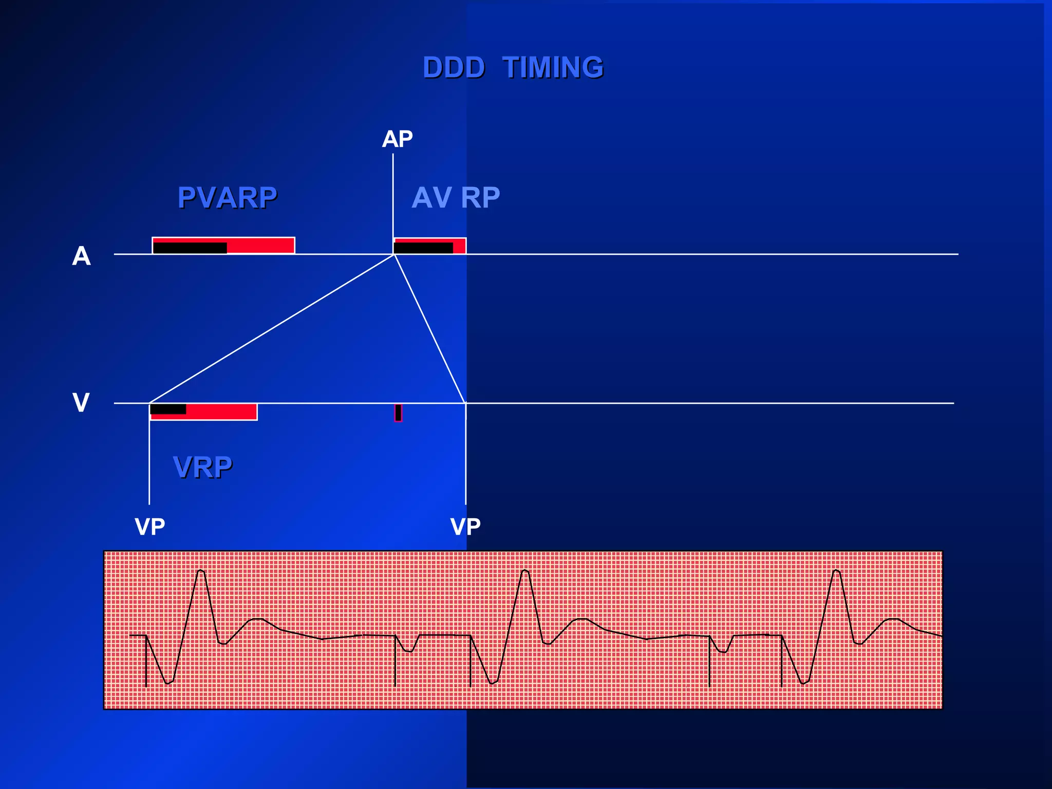 VP
AP
A
V
PVARPPVARP
VP
DDD TIMINGDDD TIMING
VP
VRPVRP
PVARPPVARP AV RP
 