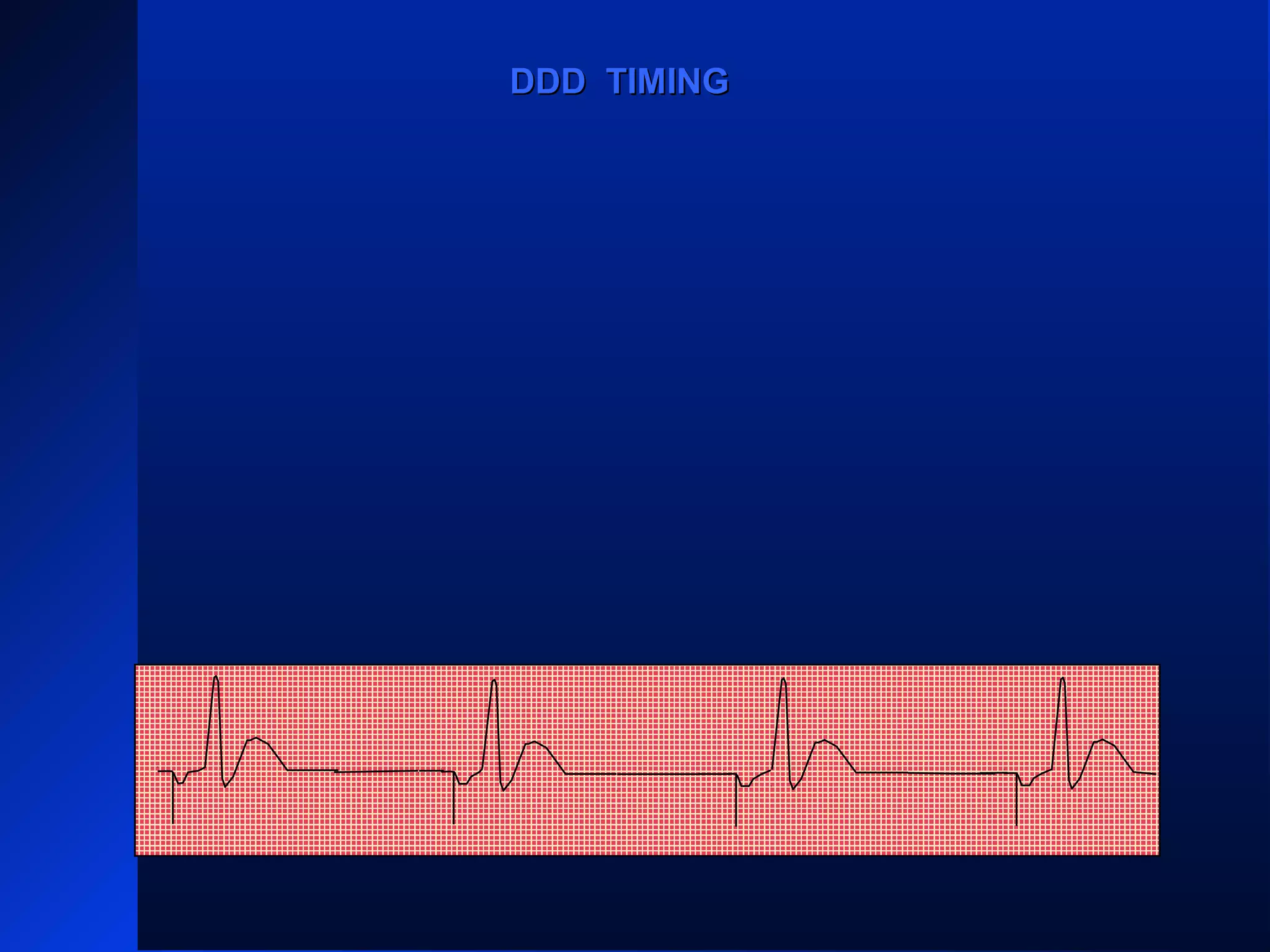 VS VS
AP AP
VSVS
AP
DDD TIMINGDDD TIMING
 
