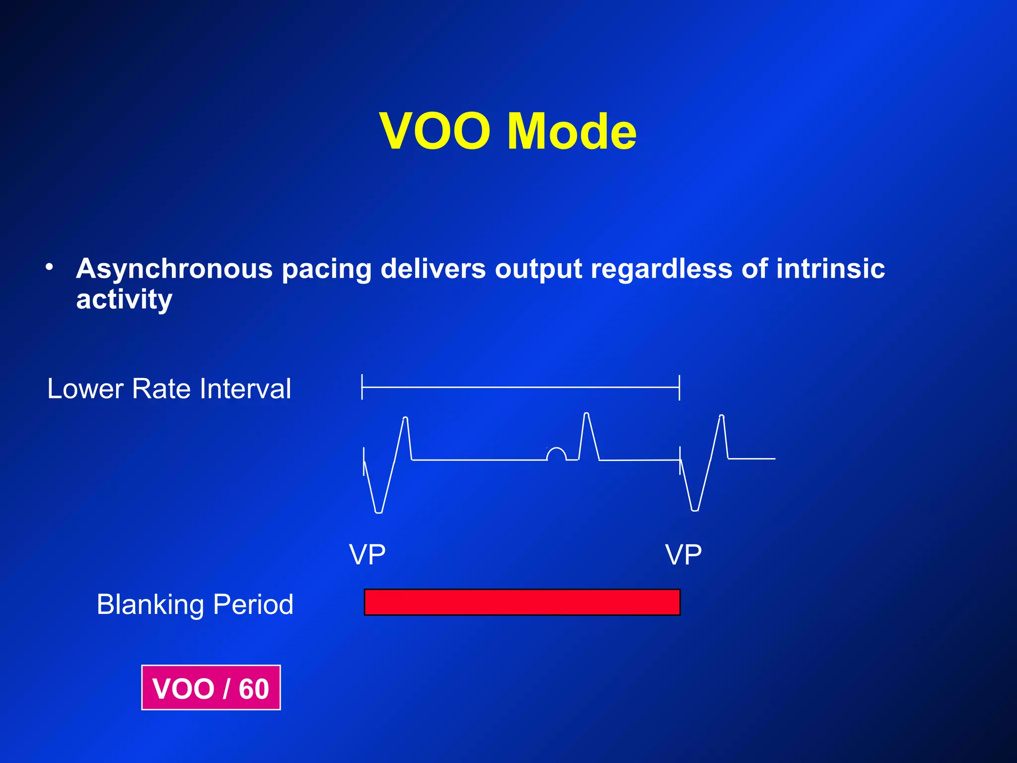 VOO Mode
Blanking Period
VP VP
Lower Rate Interval
VOO / 60
• Asynchronous pacing delivers output regardless of intrinsic
activity
 