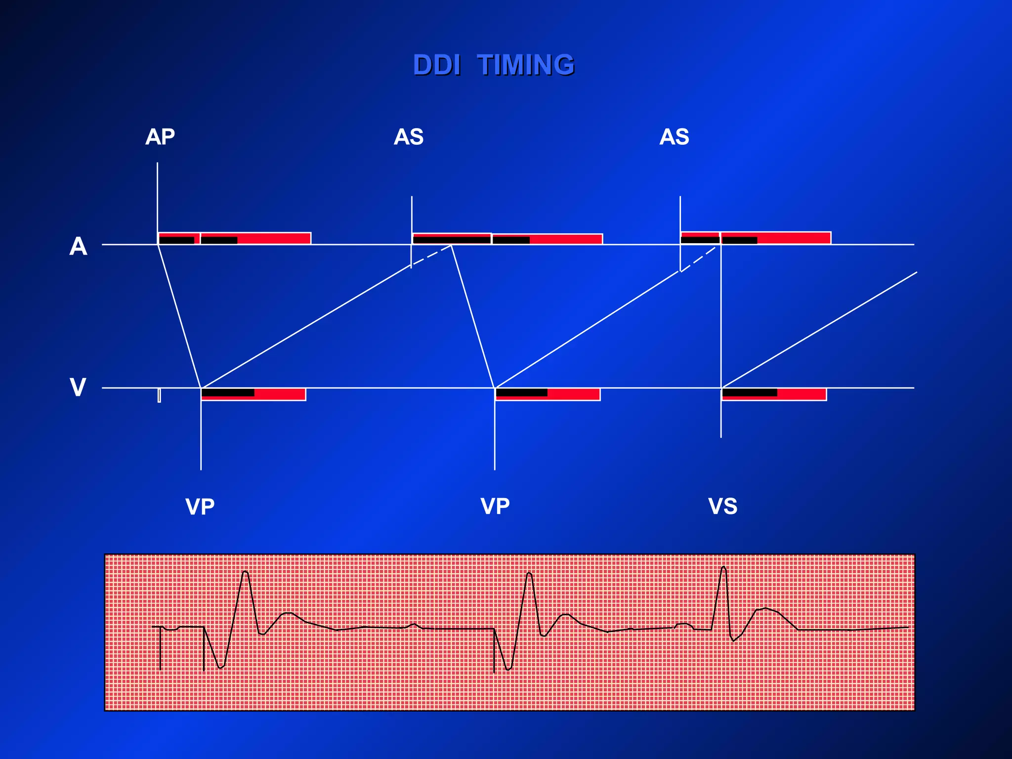 DDI TIMINGDDI TIMING
AP
A
V
AS AS
VP VP VS
 