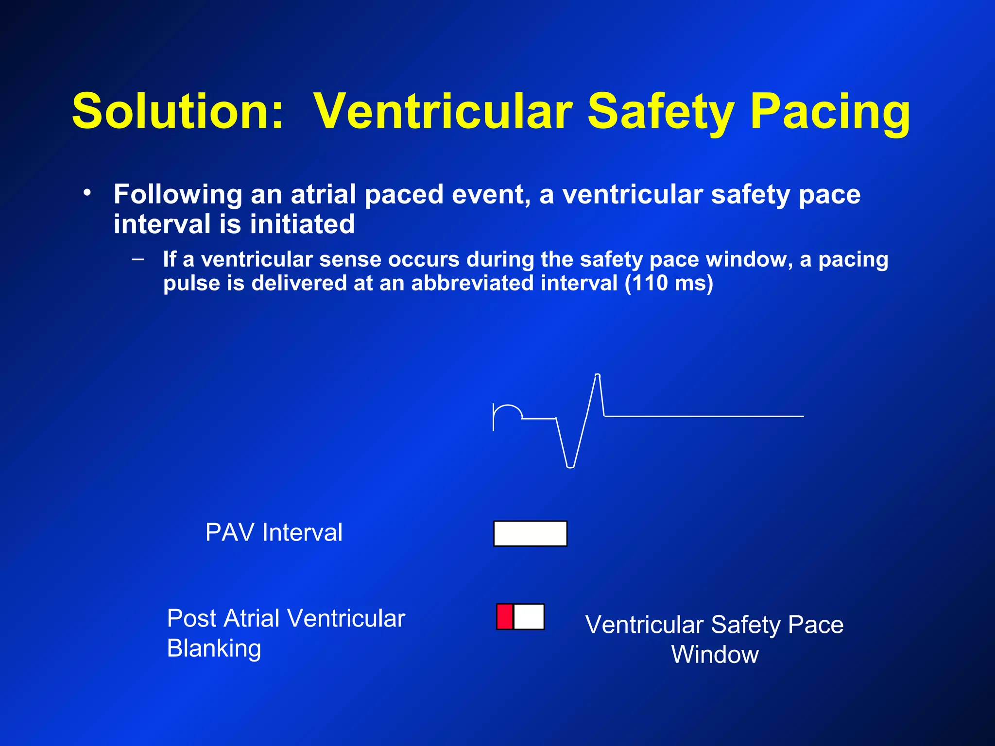 Solution: Ventricular Safety Pacing
• Following an atrial paced event, a ventricular safety pace
interval is initiated
– If a ventricular sense occurs during the safety pace window, a pacing
pulse is delivered at an abbreviated interval (110 ms)
Post Atrial Ventricular
Blanking
PAV Interval
Ventricular Safety Pace
Window
 
