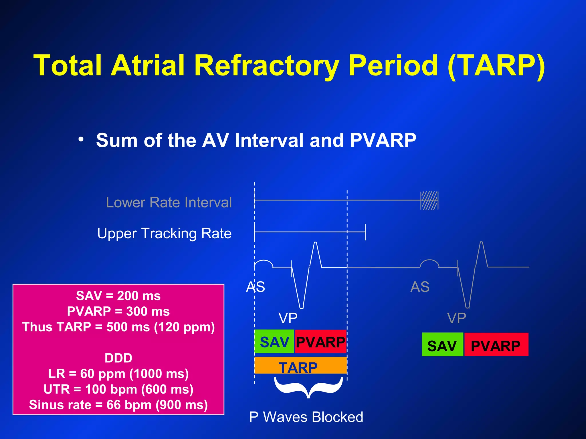 PVARP
Upper Tracking Rate
Lower Rate Interval
{
P Waves Blocked
AS AS
VPVP
SAV = 200 ms
PVARP = 300 ms
Thus TARP = 500 ms (120 ppm)
DDD
LR = 60 ppm (1000 ms)
UTR = 100 bpm (600 ms)
Sinus rate = 66 bpm (900 ms)
SAV
TARP
PVARP
Total Atrial Refractory Period (TARP)
• Sum of the AV Interval and PVARP
SAV
 