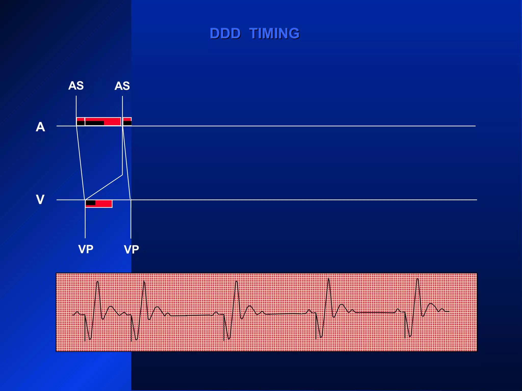 AS
VP
AS AS
VP VP
AS AS
ARARAR
VP
AR
VP
A
V
DDD TIMINGDDD TIMING
 