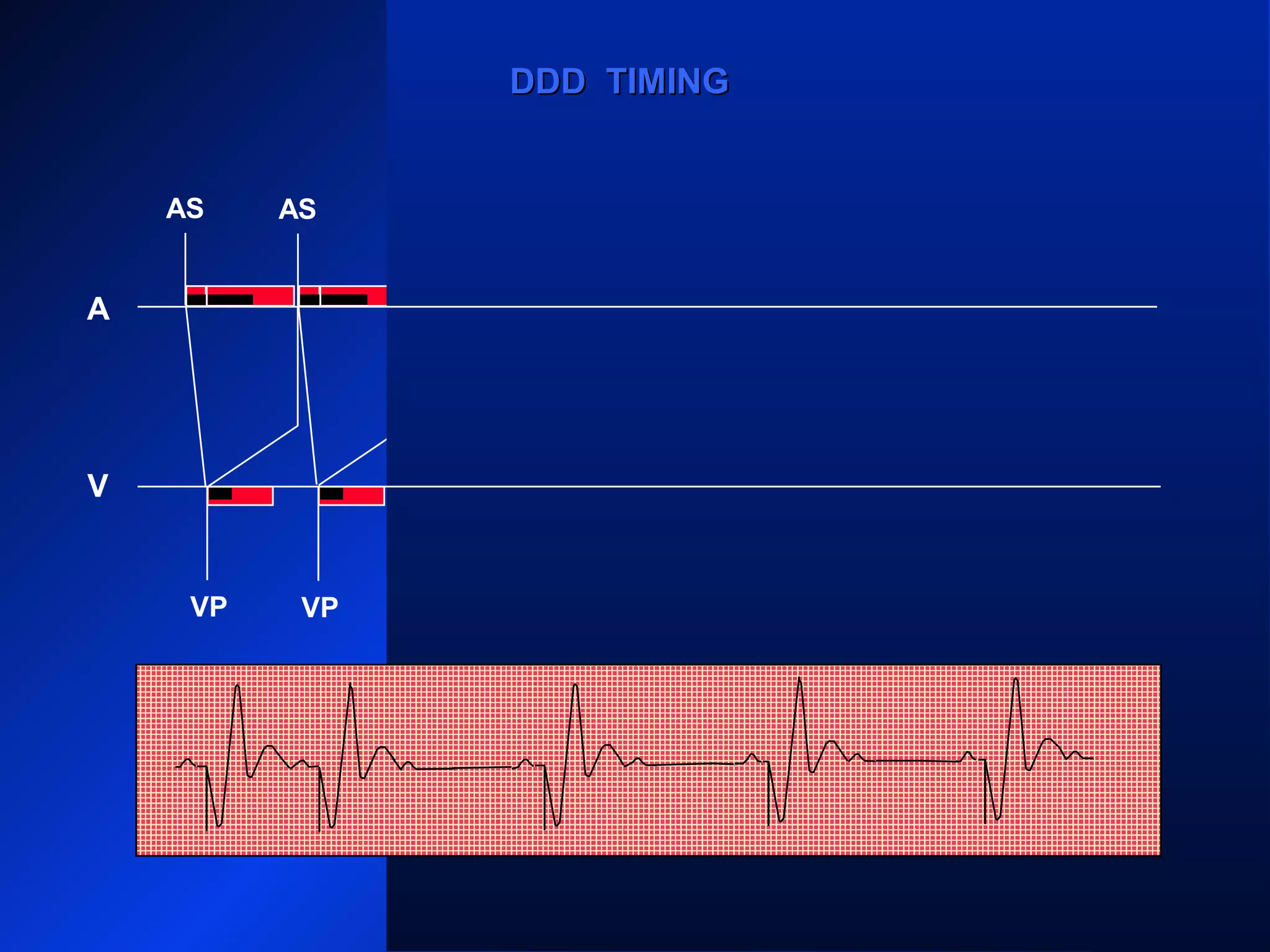 AS
VP VP
AS AS
VP VP
AS AS
ARARAR
VP
AR
A
V
DDD TIMINGDDD TIMING
 
