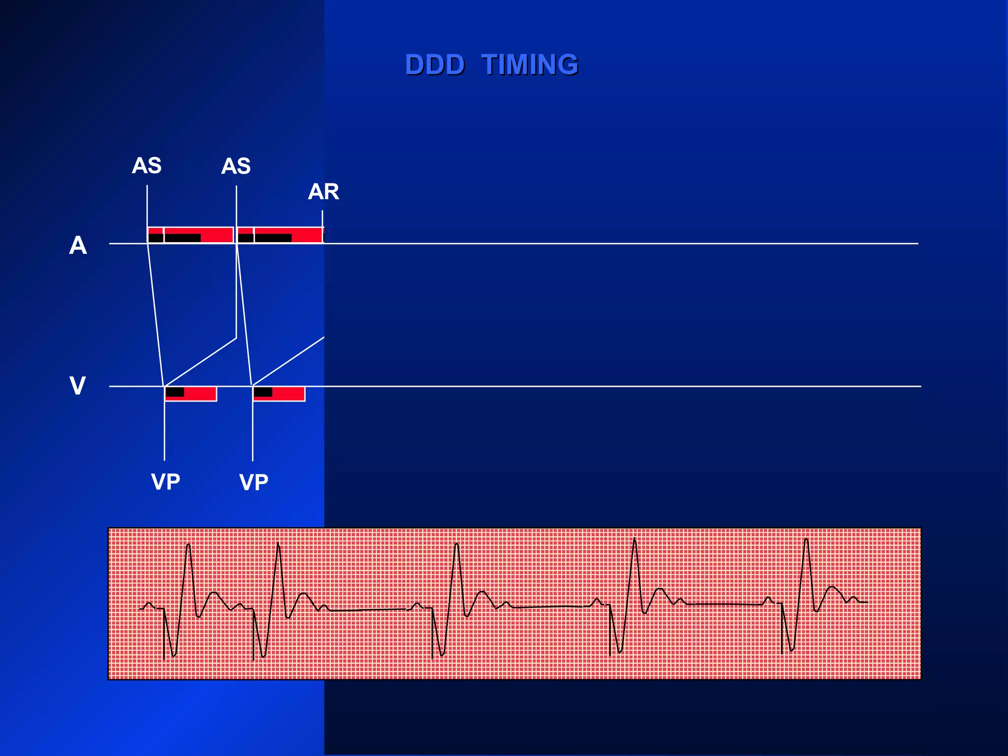 AS
VP VP
AS AS
VP VP
AS AS
ARARAR
VP
A
V
AR
DDD TIMINGDDD TIMING
 