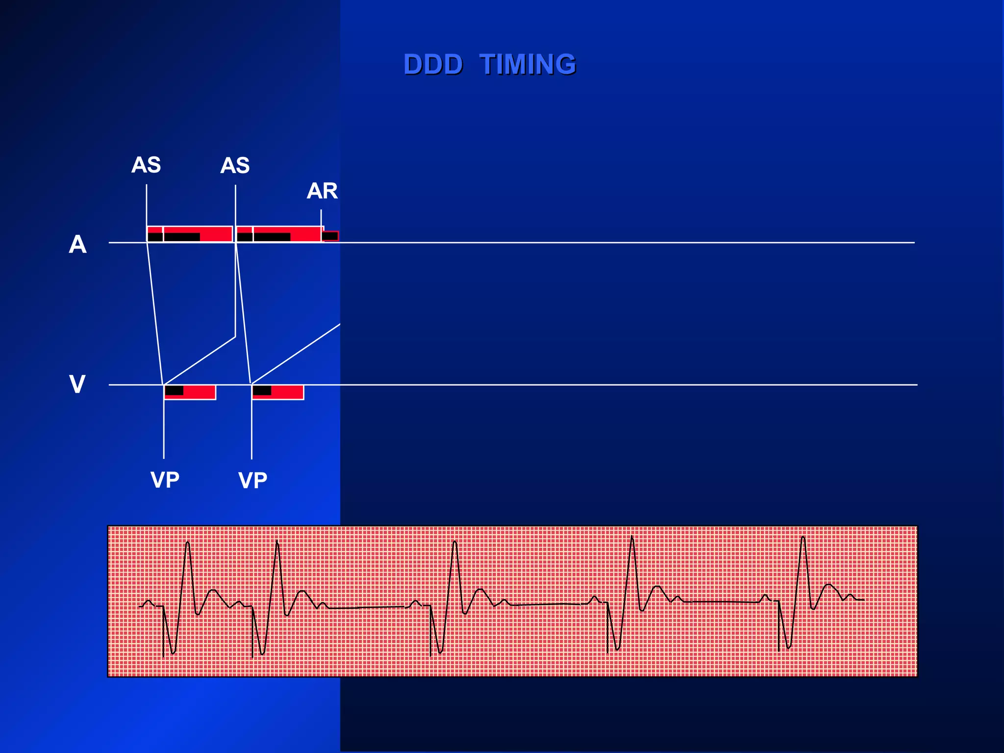 AS
VP VP
AS AS
VP VP
AS AS
AR ARARAR
VP
A
V
DDD TIMINGDDD TIMING
 
