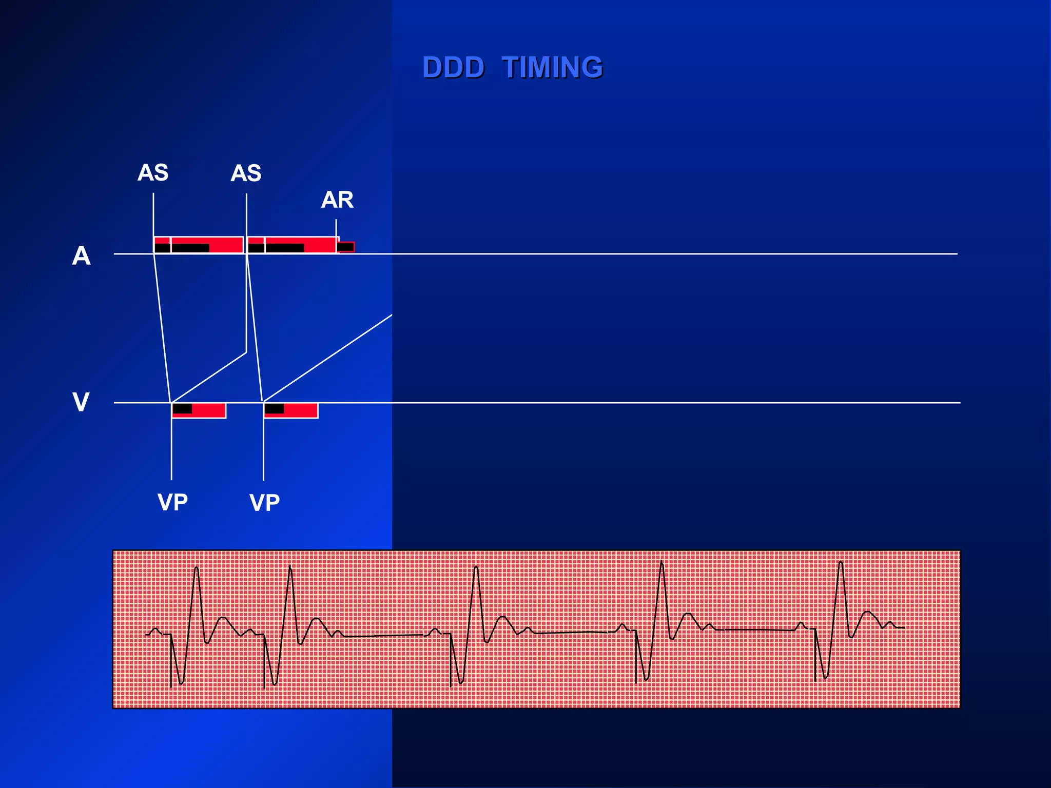 AS
VP VP
AS AS
VP VP
AS AS
AR ARARAR
VP
A
V
DDD TIMINGDDD TIMING
 