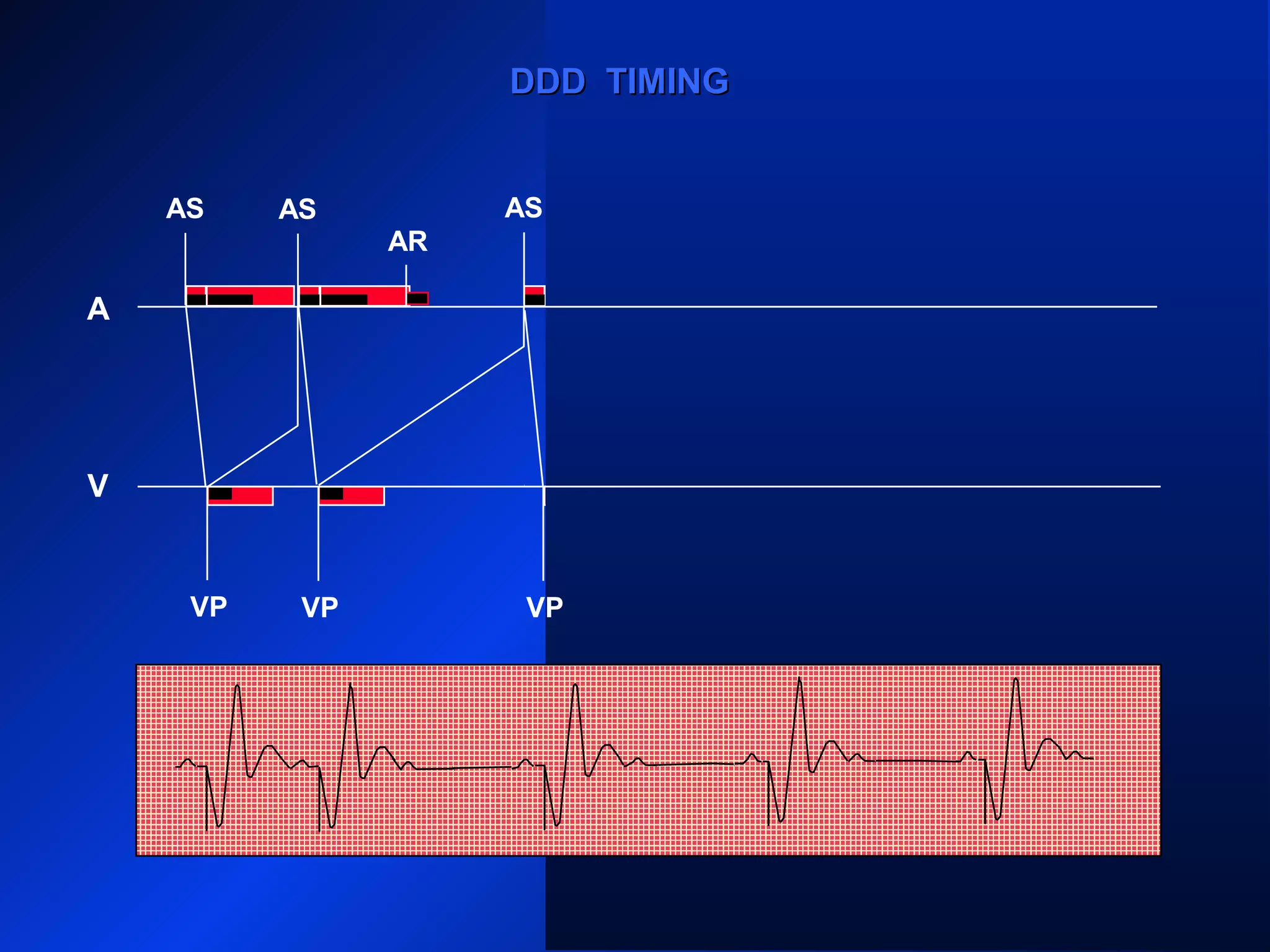 AS
VP VP
AS AS
VP VP
AS AS
AR ARARAR
VP
A
V
DDD TIMINGDDD TIMING
 
