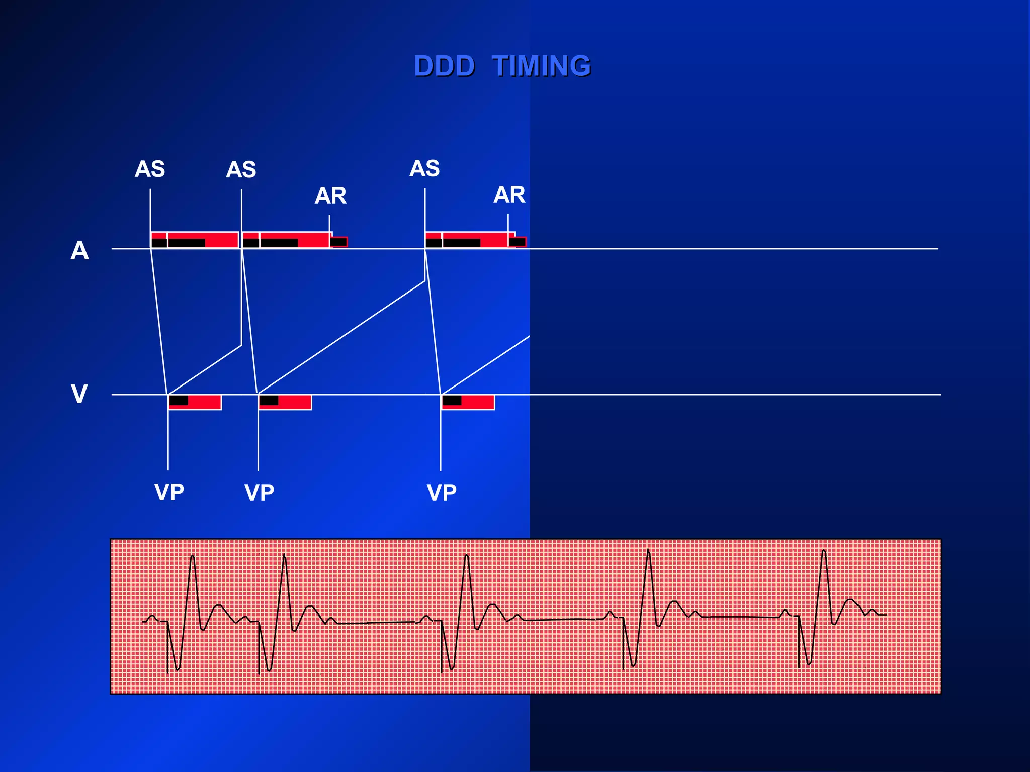 AS
VP VP
AS AS
VP VP VP
AS AS
AR ARARAR
A
V
DDD TIMINGDDD TIMING
 