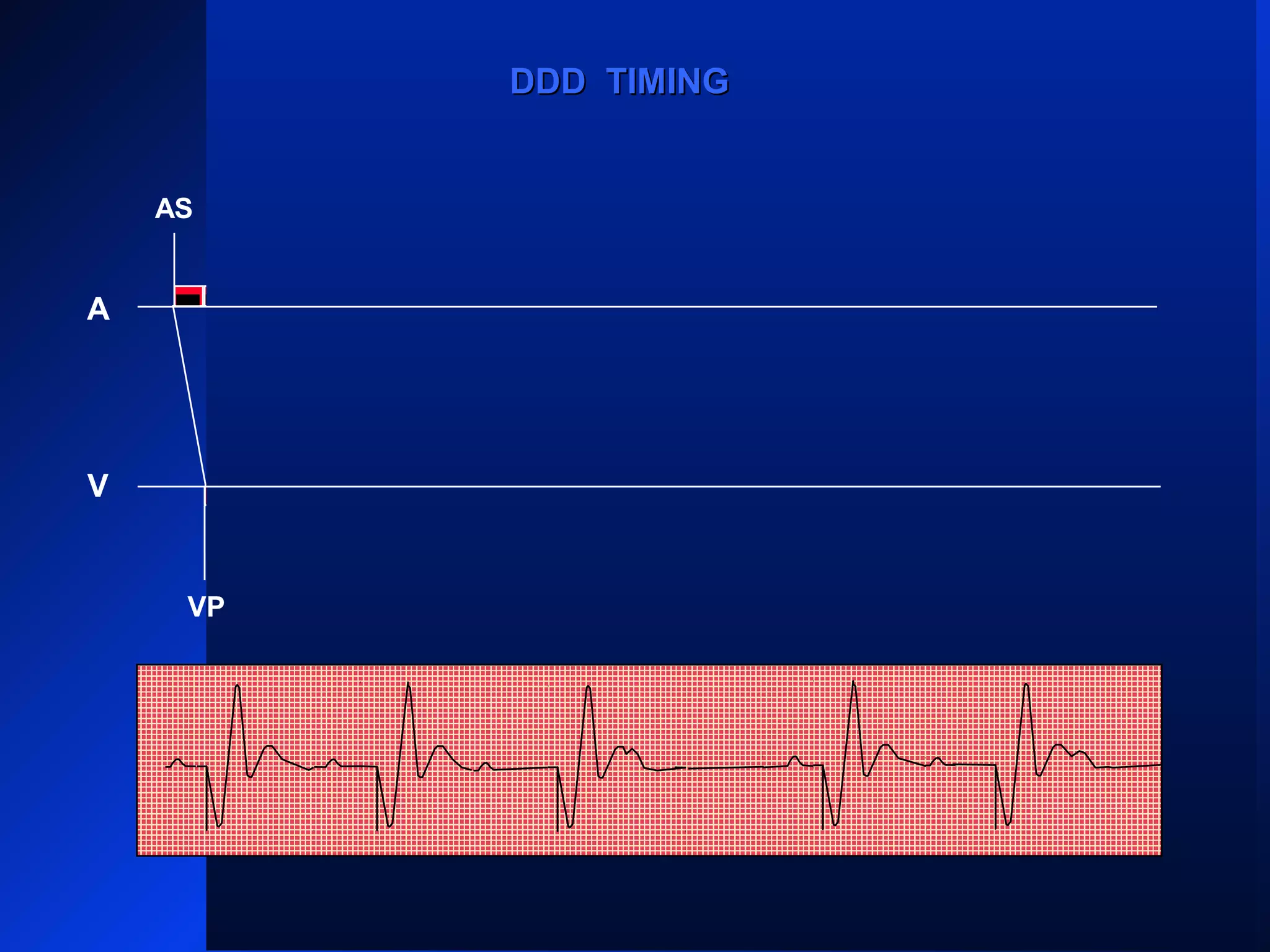 ASAS AS AS
AR
VPVP
AS
VP VP
AS
DDD TIMINGDDD TIMING
VP
A
V
 