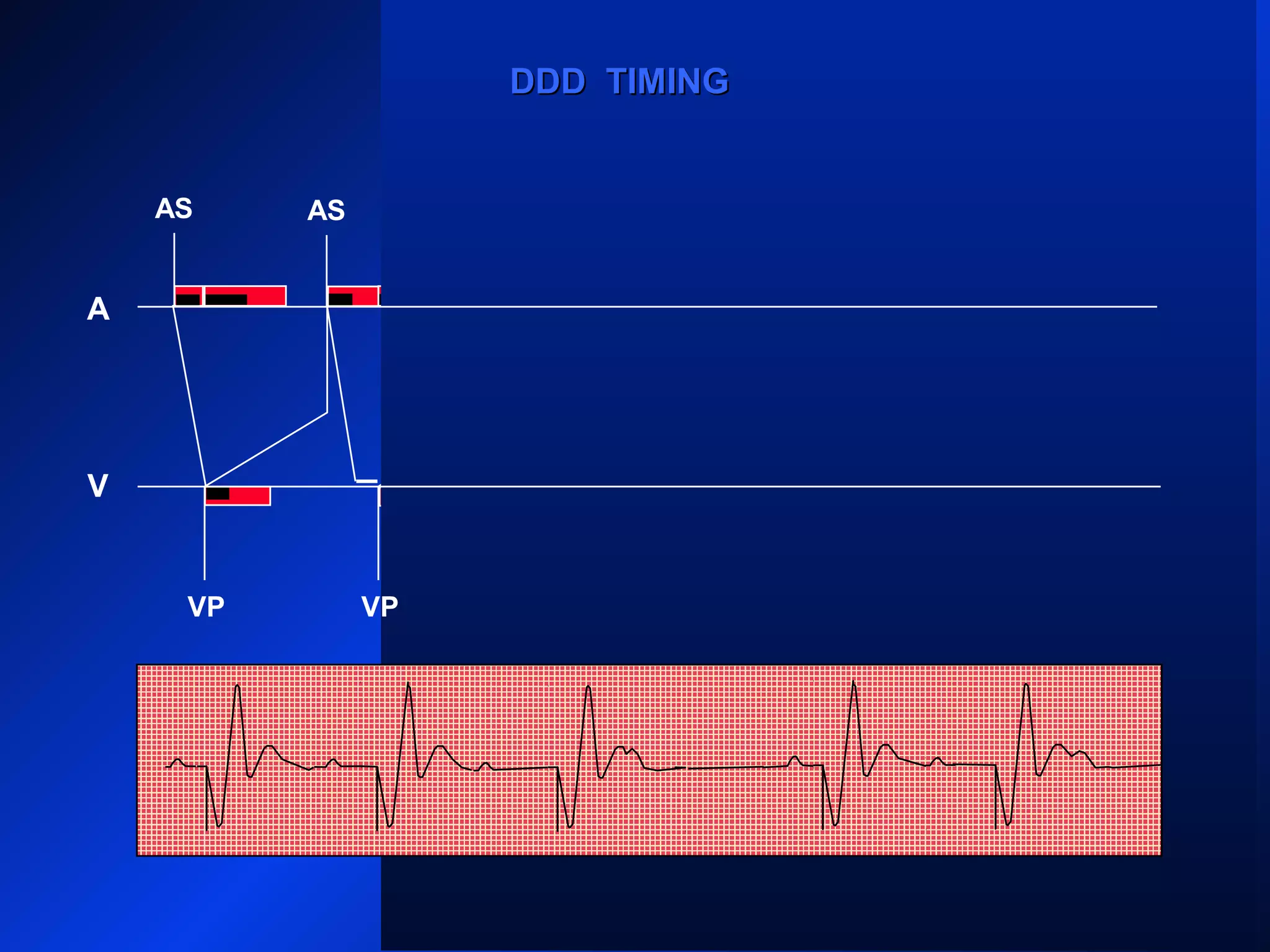 VP
AS ASAS AS AS
AR
VPVP
AS
VP
A
V
DDD TIMINGDDD TIMING
VP
 
