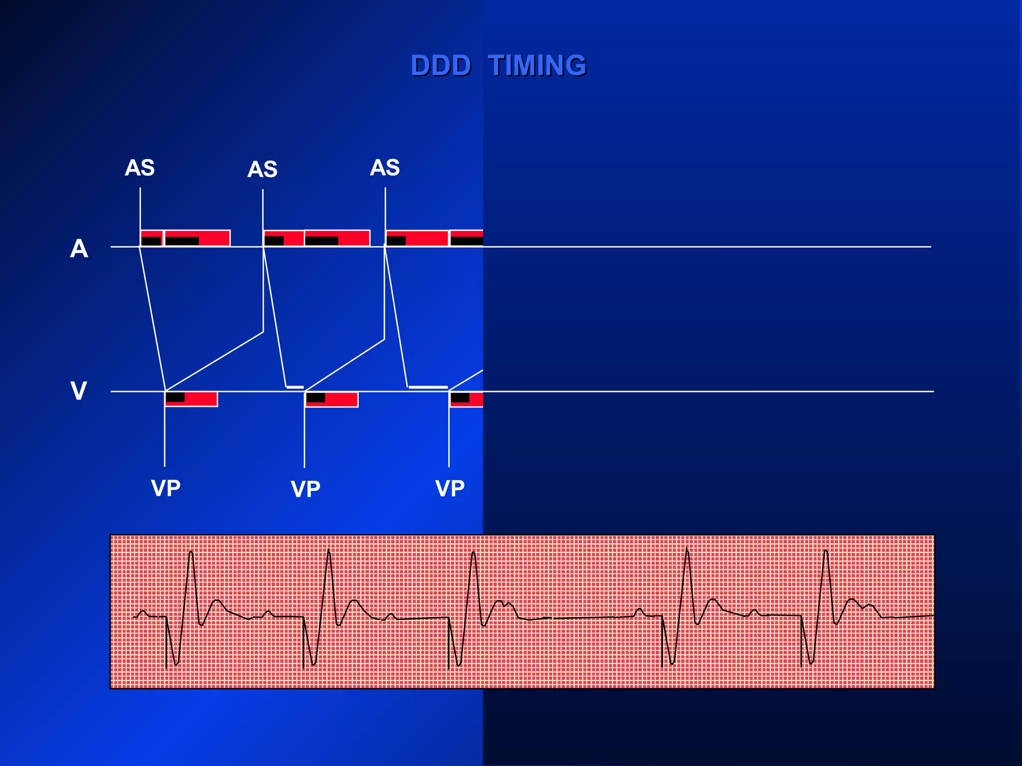 VP
AS
VP VP
AS ASAS AS AS
AR
VPVP
A
V
DDD TIMINGDDD TIMING
 
