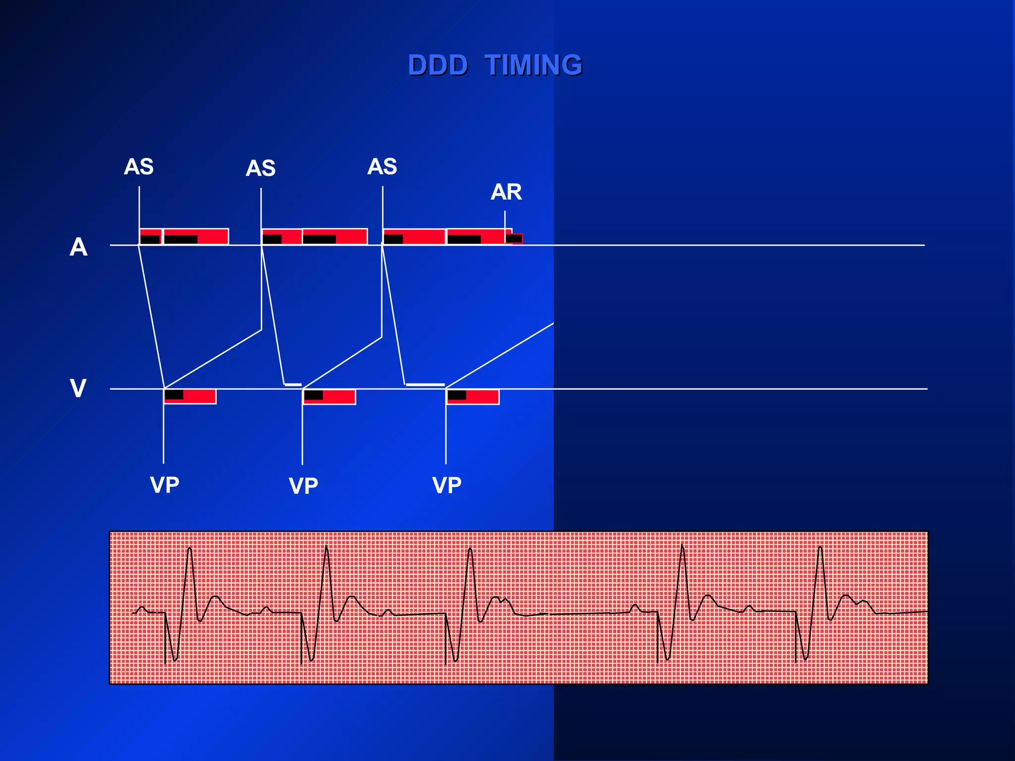 VP
AS
VP VP
AS ASAS AS AS
AR
VPVP
DDD TIMINGDDD TIMING
A
V
 