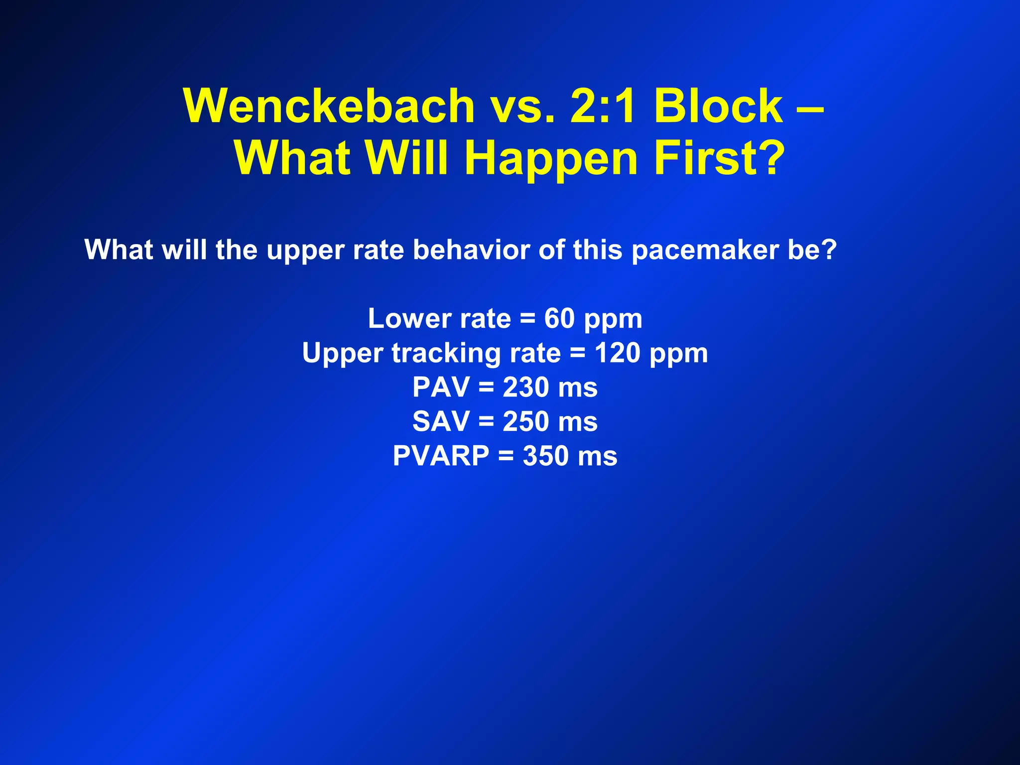 Wenckebach vs. 2:1 Block –
What Will Happen First?
What will the upper rate behavior of this pacemaker be?
Lower rate = 60 ppm
Upper tracking rate = 120 ppm
PAV = 230 ms
SAV = 250 ms
PVARP = 350 ms
 
