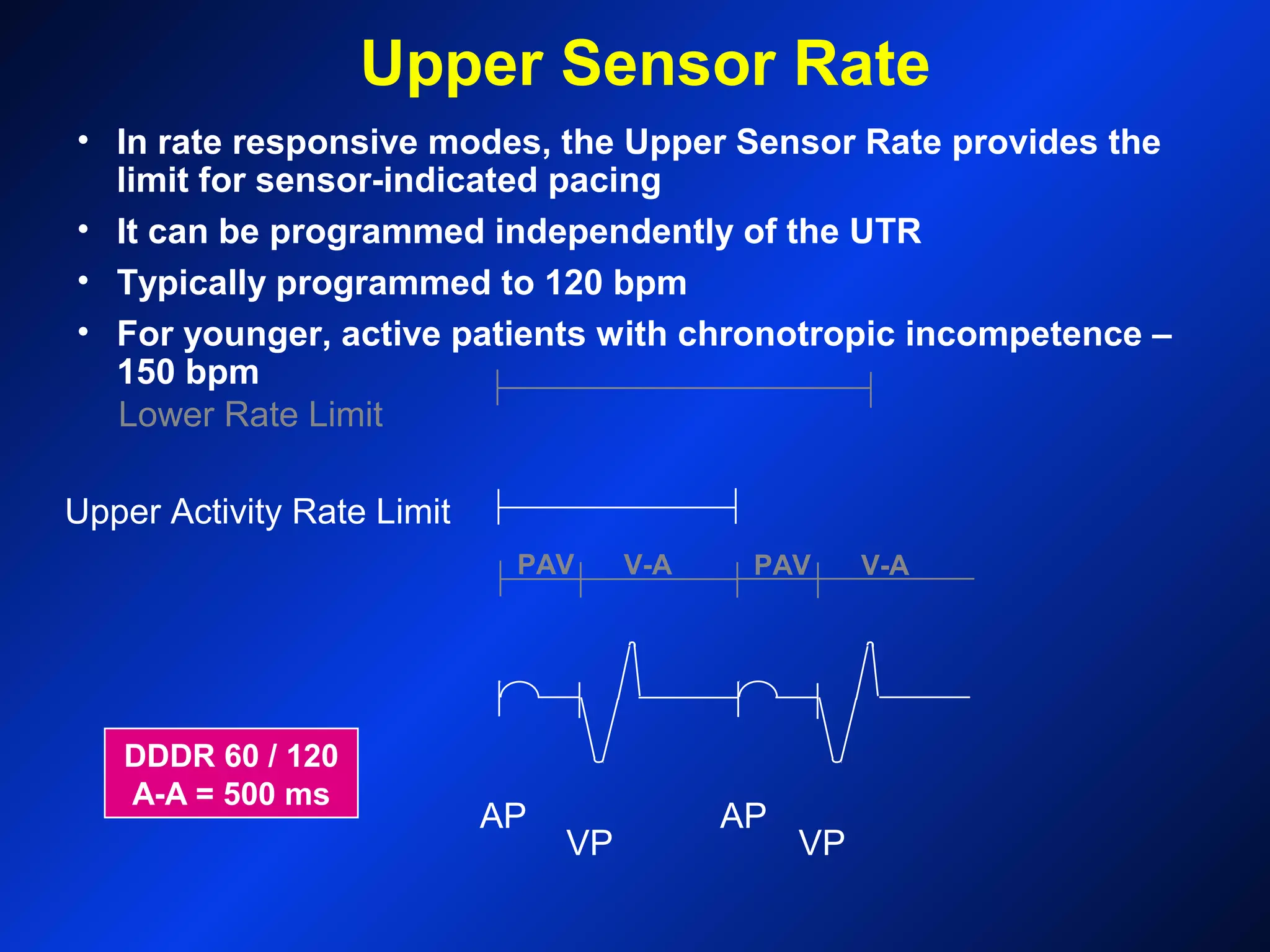 DDDR 60 / 120
A-A = 500 ms
AP
VP
AP
VP
Upper Activity Rate Limit
Lower Rate Limit
V-APAV V-APAV
Upper Sensor Rate
• In rate responsive modes, the Upper Sensor Rate provides the
limit for sensor-indicated pacing
• It can be programmed independently of the UTR
• Typically programmed to 120 bpm
• For younger, active patients with chronotropic incompetence –
150 bpm
 