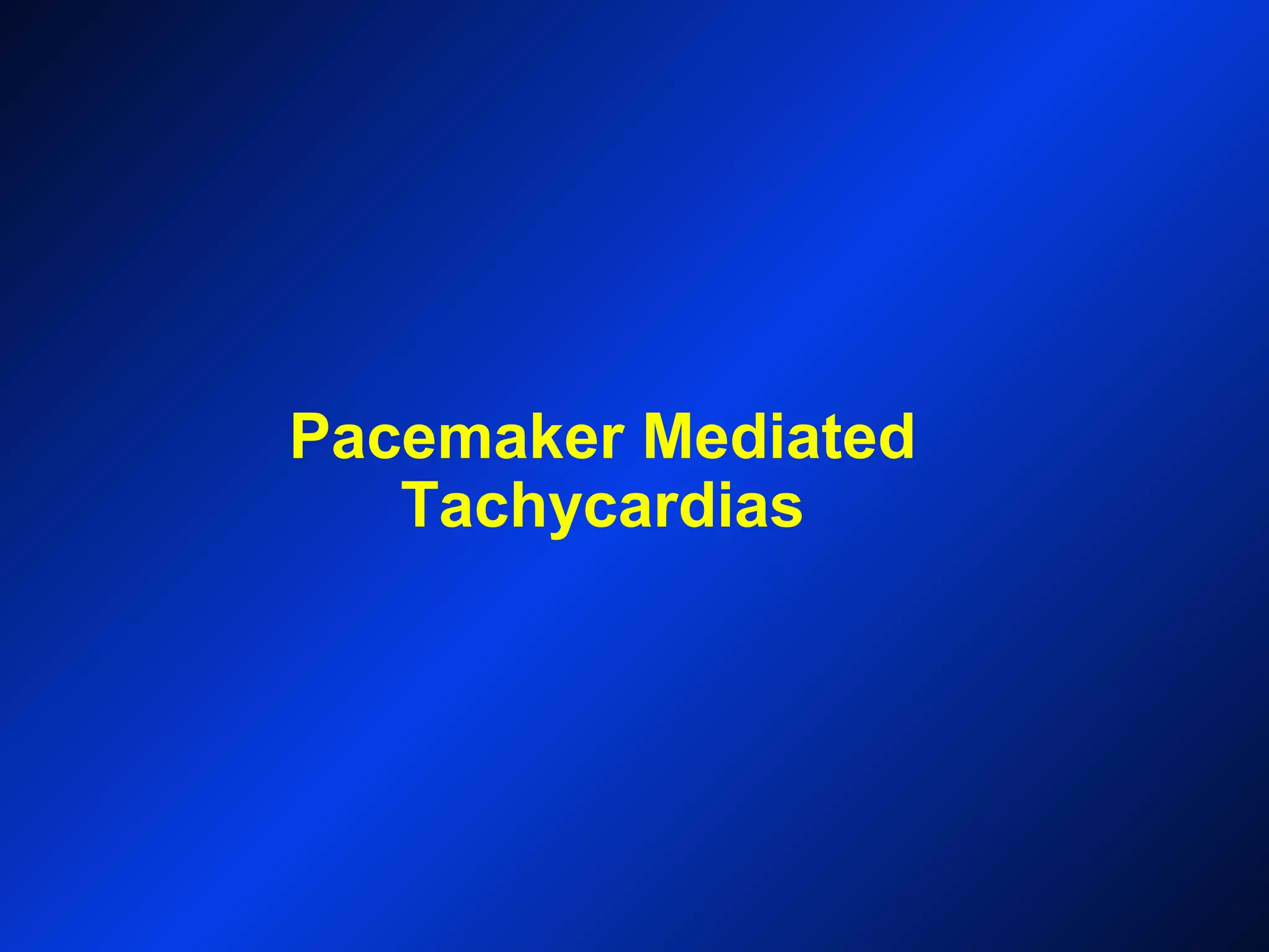 Pacemaker Mediated
Tachycardias
 