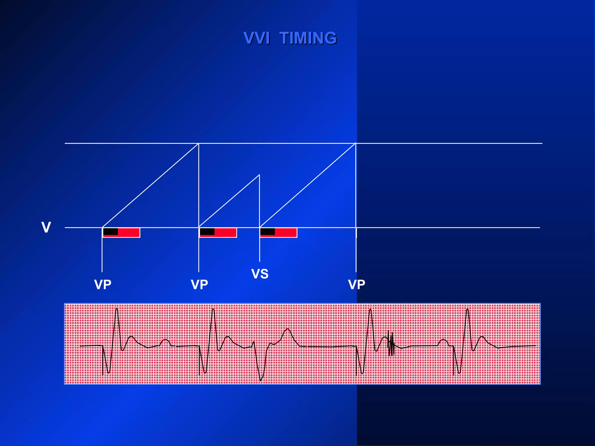 VP VP
VS
VPVP
V
VVI TIMINGVVI TIMING
 