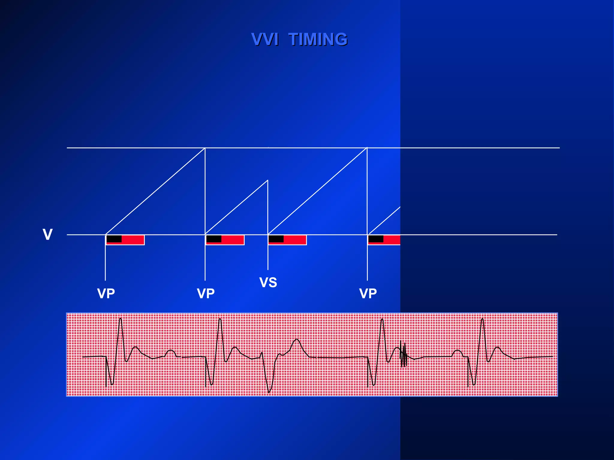 VP VP
VS
VP VP
V
VVI TIMINGVVI TIMING
 