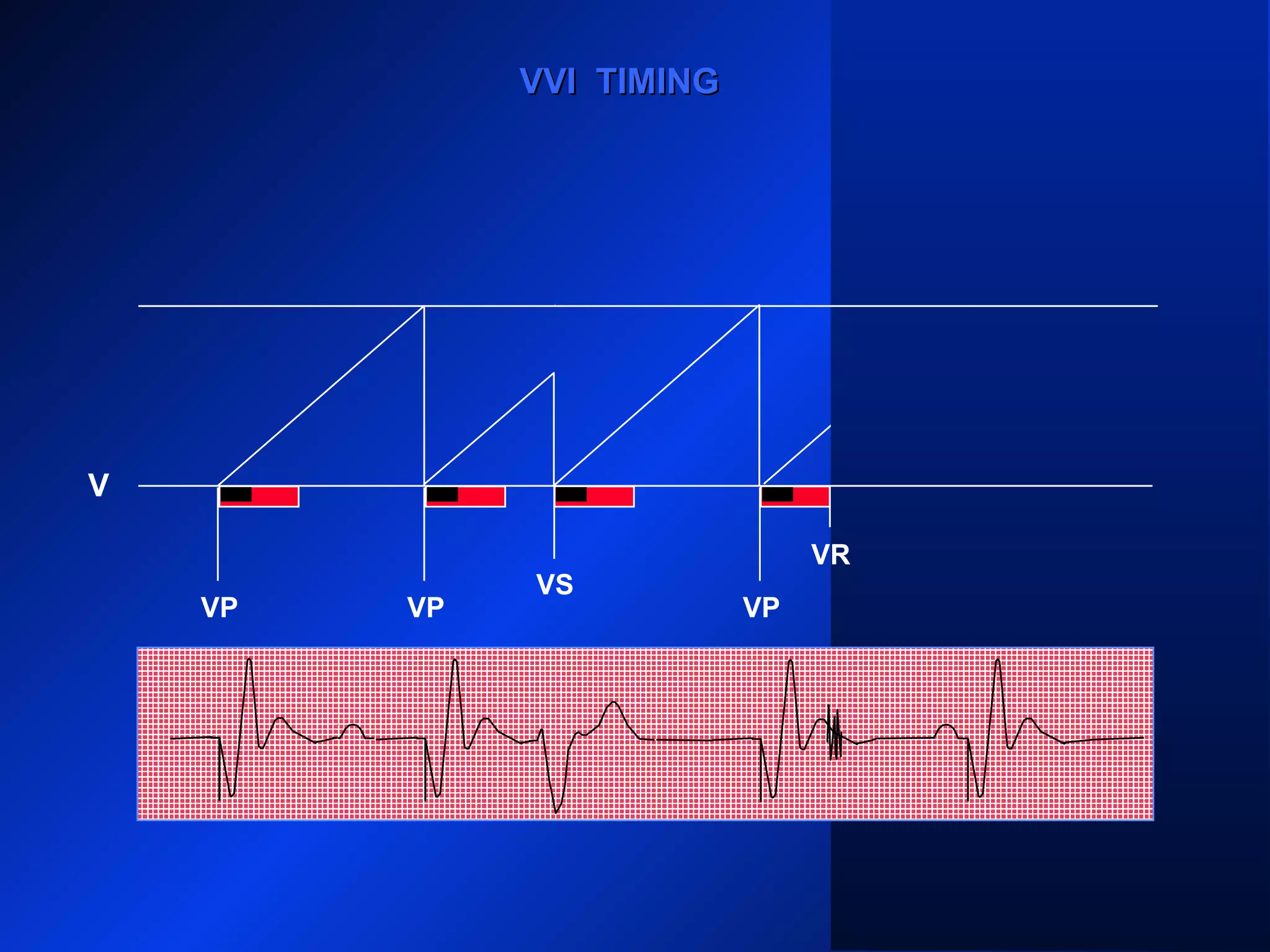 VP VP
VS
VP VP
V
VR
VVI TIMINGVVI TIMING
 
