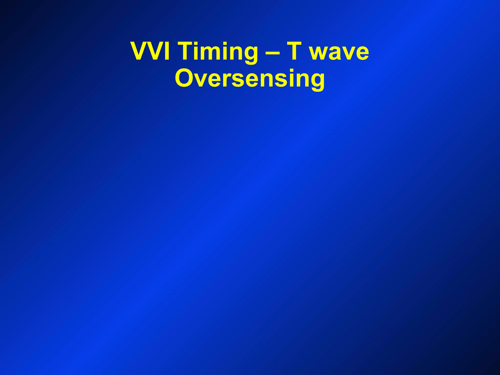 VVI Timing – T wave
Oversensing
 