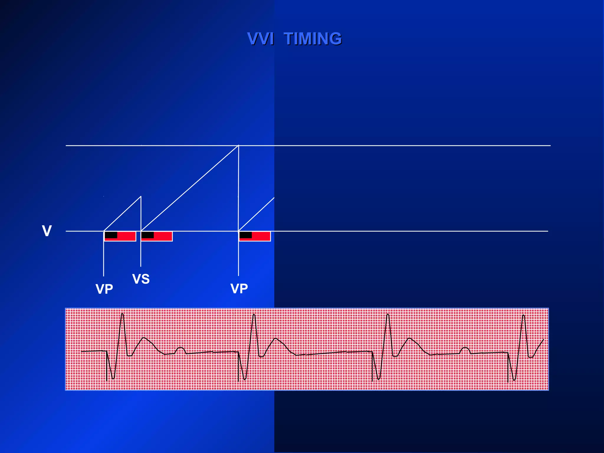 VP VP
VS
VP
VS
VP
VVI TIMINGVVI TIMING
V
 