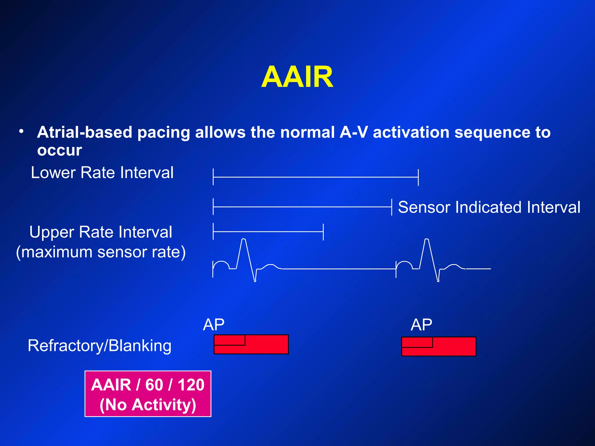 AAIR
Lower Rate Interval
AP AP
Refractory/Blanking
Upper Rate Interval
(maximum sensor rate)
AAIR / 60 / 120
(No Activity)
• Atrial-based pacing allows the normal A-V activation sequence to
occur
Sensor Indicated Interval
 