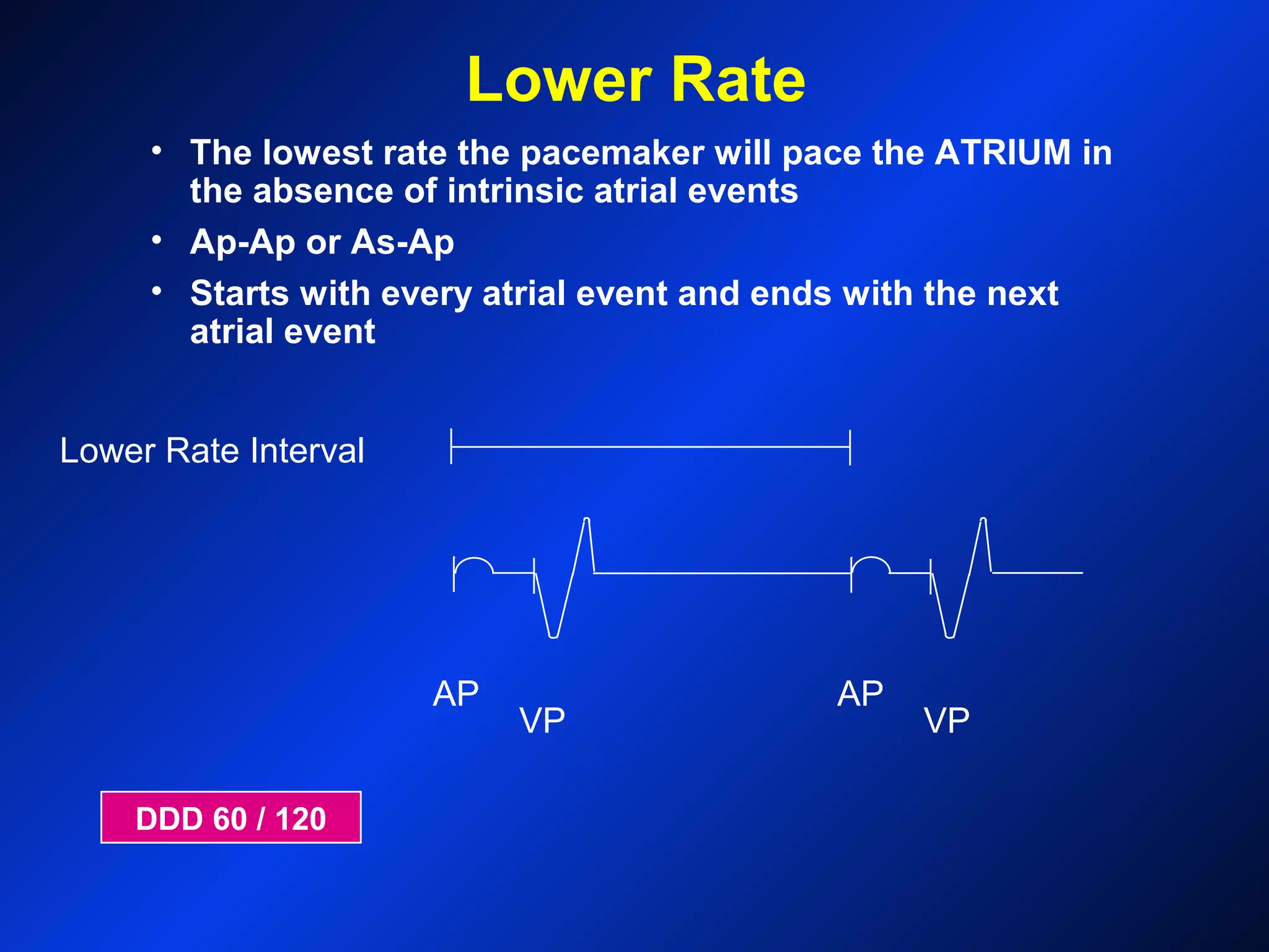 Lower Rate Interval
AP
VP
AP
VP
Lower Rate
• The lowest rate the pacemaker will pace the ATRIUM in
the absence of intrinsic atrial events
• Ap-Ap or As-Ap
• Starts with every atrial event and ends with the next
atrial event
DDD 60 / 120
 