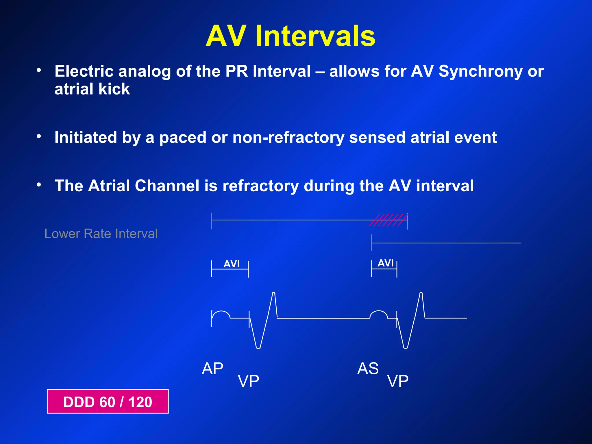AP
VP
AS
VP
AVI AVI
Lower Rate Interval
AV Intervals
• Electric analog of the PR Interval – allows for AV Synchrony or
atrial kick
• Initiated by a paced or non-refractory sensed atrial event
• The Atrial Channel is refractory during the AV interval
DDD 60 / 120
 